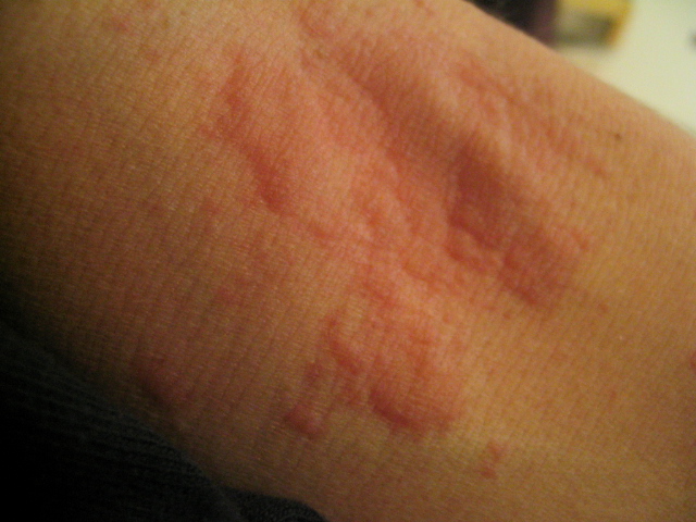 flickr.com/photos/ espelina/ 24831708